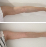 「二の腕☆」の画像（1枚目）