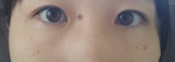 「サプリで実感、顔のむくみ解消！」の画像（1枚目）