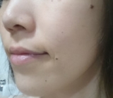 「顔のむくみサプリ♡」の画像（2枚目）
