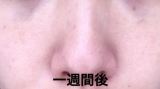 「たるみ毛穴に。」の画像（2枚目）