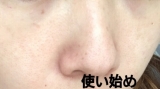 「たるみ毛穴に。」の画像（1枚目）