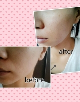 口コミ:日本酒で出来た化粧水日本盛でお肌が復活!ピカピカお肌に‼の画像(3枚目)