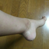 口コミ記事「こんな絆創膏が欲しかった！＼(^o^)／」の画像