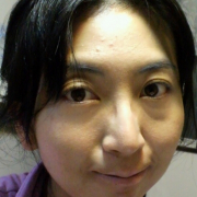 「今はおでこです」【あごニキビ用オールインワンジェル・7000円相当を10名様に】モニター様大募集の投稿画像