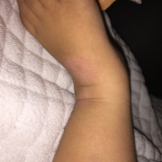 「カサカサ肌」【発売前新商品】アトピー性皮膚炎のお子様向けスキンケアモニター30名様大募集！の投稿画像