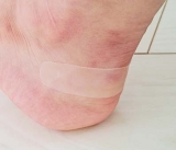 口コミ記事「キズクイック」の画像