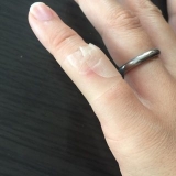 口コミ：キズクイックの画像（2枚目）