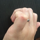 口コミ記事「キズクイック」の画像