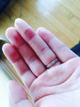 口コミ：手荒れの画像（3枚目）