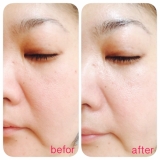 「素肌目覚めた【FINALIFT ファイナリフト】」の画像（1枚目）