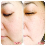 【シーバムコントロールVCローション】★モニター★1回目★