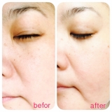 【シーバムコントロールVCローション】★モニター★2回目★