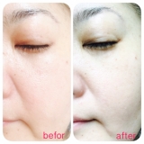 【シーバムコントロールVCローション】★モニター★3回目★