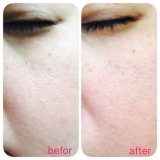 「【ぱっくり毛穴専用美容液ソワンサンプル】★モニター★」の画像