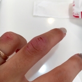 口コミ記事「手荒れ保護フィルム」の画像