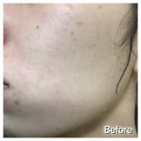 「顔のコルセットみたい。」の画像（1枚目）