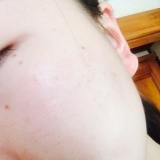 「リフトアップとハリを実感」の画像（3枚目）