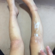 「保湿タイム」【発売前新商品】アトピー性皮膚炎のお子様向けスキンケアモニター20名様大募集！の投稿画像