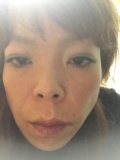 肌が汚い&hellip;