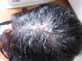 「頭皮が生まれ変わった！」の画像（3枚目）
