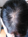 「頭皮が生まれ変わった！」の画像（1枚目）