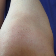 「膝です。」【新商品♪現品をプレゼント！！】ムダ毛の処理に関するモニターアンケートの投稿画像