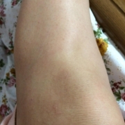 「毛穴とひざ」【新商品♪現品をプレゼント！！】ムダ毛の処理に関するモニターアンケートの投稿画像