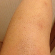 「ふくらはぎです。」【新商品♪現品をプレゼント！！】ムダ毛の処理に関するモニターアンケートの投稿画像