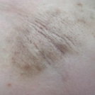 「顔出しＯＫです！ 　」【新商品♪現品をプレゼント！！】ムダ毛の処理に関するモニターアンケートの投稿画像