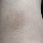 「膝です。」【新商品♪現品をプレゼント！！】ムダ毛の処理に関するモニターアンケートの投稿画像