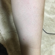 「脚のムダ毛」【新商品♪現品をプレゼント！！】ムダ毛の処理に関するモニターアンケートの投稿画像