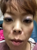 たるんで来たしかさかさだなぁ〜〜