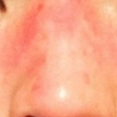 「顔出しＯＫです！ 　」【商品サンプル30名様にプレゼント!】敏感肌・敏感肌の方向け簡単３０秒アンケートの投稿画像