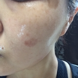 美白とプルルン肌へ♡