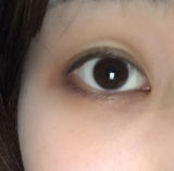 くまがひどい目元