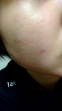 「肌に透明感が出ました！」の画像（1枚目）