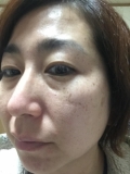 「使用後」の画像（1枚目）