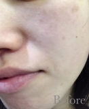 透明感&うるおいUP肌に