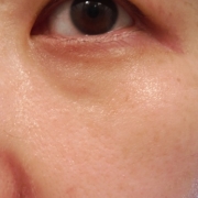 「まつ毛があるかわからない目元」まつげやまぶたにお悩みをお持ちの方！アイケア商品のモニター募集！の投稿画像