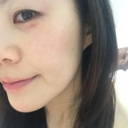 「目元の写真です」まつげやまぶたにお悩みをお持ちの方！アイケア商品のモニター募集！の投稿画像