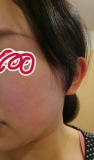 肌の赤みが落ち着いて均一になりました。