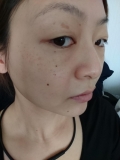 毛穴が引き締まる