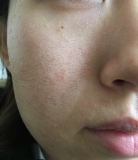 超保湿毛穴小化粧水サンプルモニター3日目の写真！