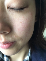 口コミ：【モニター当選】シーバムコントロールVCローションの画像（4枚目）