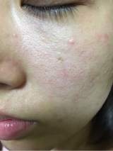 口コミ：【モニター当選】シーバムコントロールVCローションの画像（3枚目）