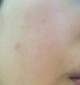 口コミ：ハイム フェイスミストの画像（4枚目）