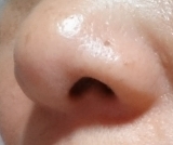 「少しは効果が・・・」の画像（2枚目）