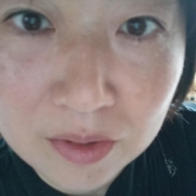 「シミ」WEBや紙媒体で商品紹介★商品PRモデル大募集！！の投稿画像