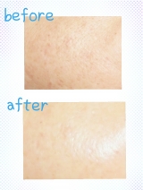 口コミ：シミを作らない！ぷるぷる美白肌へ☆透明白肌&nbsp;薬用Wホワイトエッセンスの画像（5枚目）