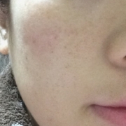 「くすみを取って、透明感のあるツルツル卵肌になりたい！」★50名様★愛用者モデル大募集！老けないために&ldquo;角質ケア&rdquo;するふきとり化粧水の投稿画像